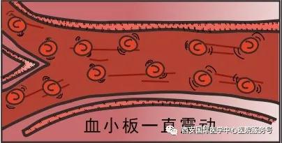 血小板是正常值的三倍？專家提醒小心血栓和出血！