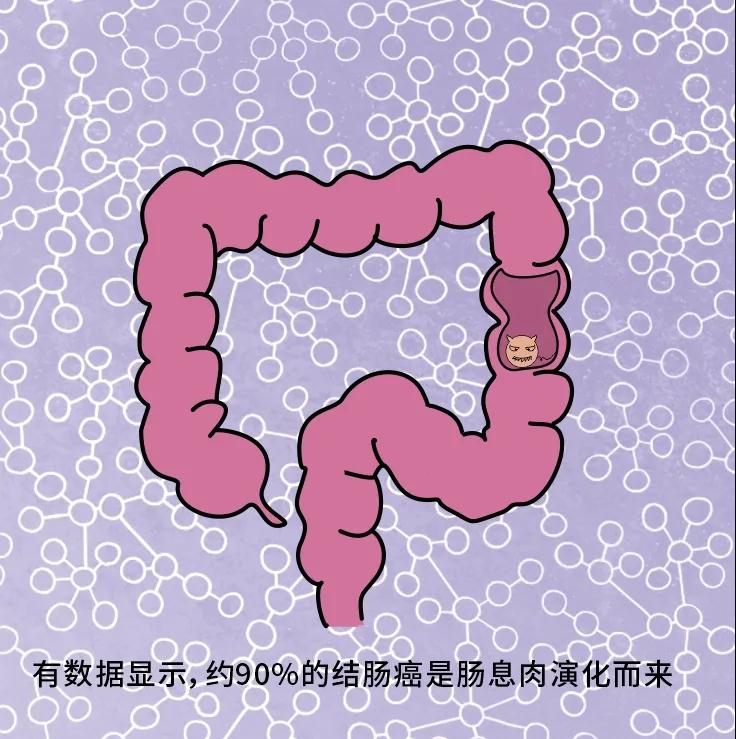 奪走“黑豹”生命的結腸癌，到底什么來頭？