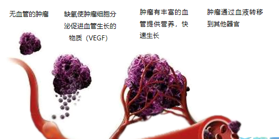 晚期腫瘤為什么會復(fù)發(fā)轉(zhuǎn)移？