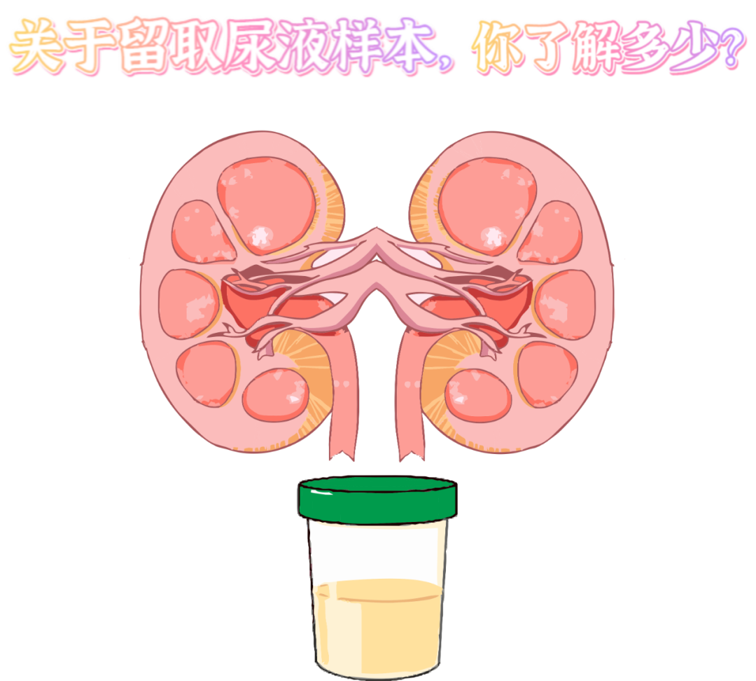 做尿檢，不得不說的注意事項(xiàng)！