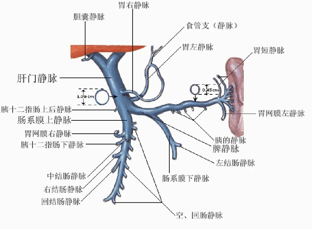 反復嘔血、黑便怎么辦？TIPS手術(shù)能解決