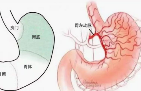 不開刀不吃藥不餓肚子，微創(chuàng)介入減肥靠譜嗎？